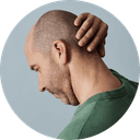 Hair Loss