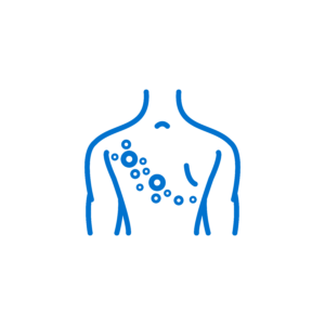 shingles image