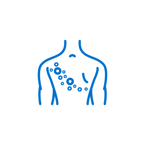shingles image