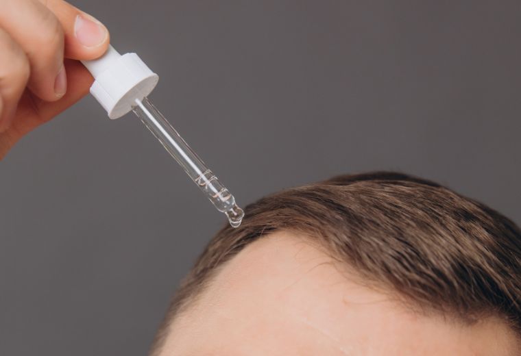 Men Hair Loss Treatment Options